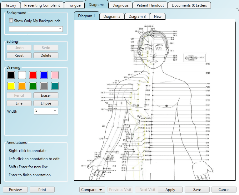 Acupuncture Charting Software